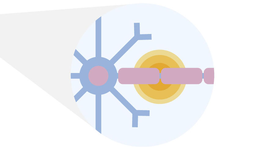 Esclerosis Múltiple